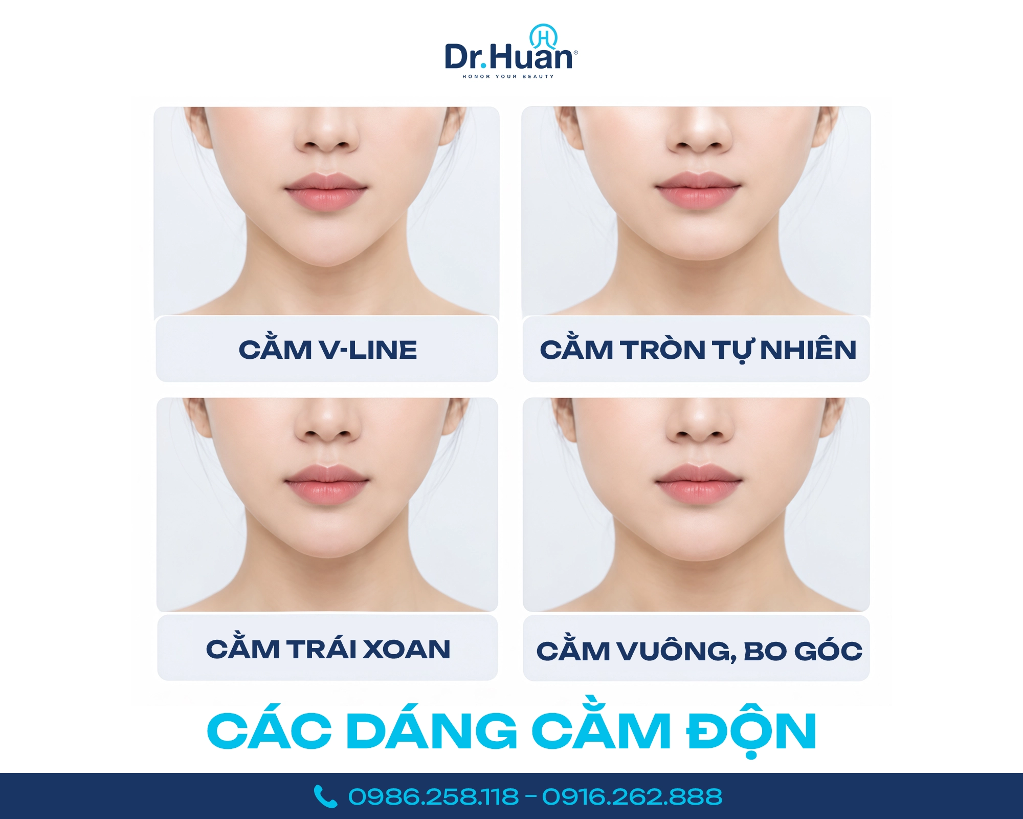 1 các dáng cằm độn