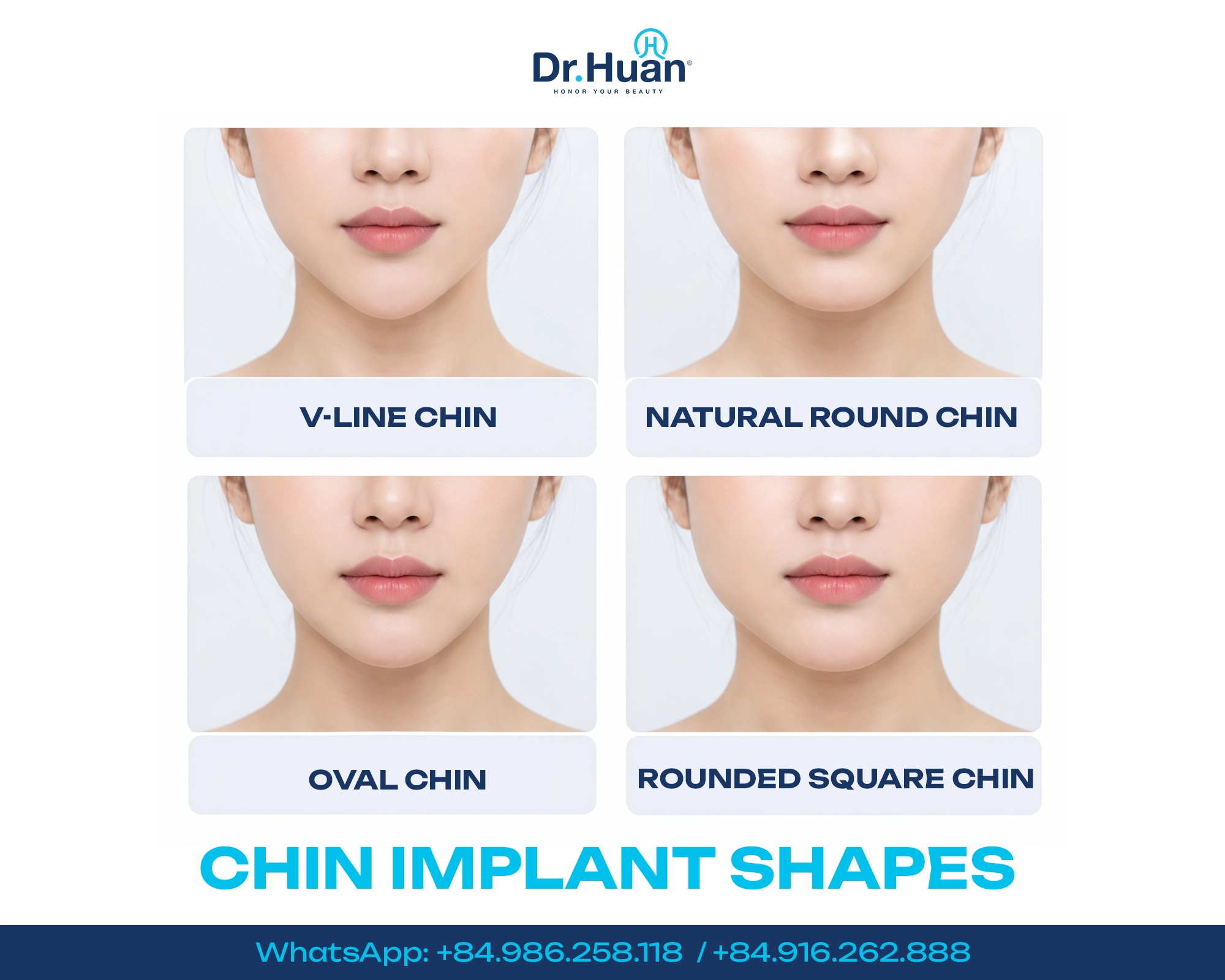 chin-implant-for-a-recessed-chin-options-costs-and-key-considerations-1 chin-implant-for-a-recessed-chin-options-costs-and-key-considerations-1