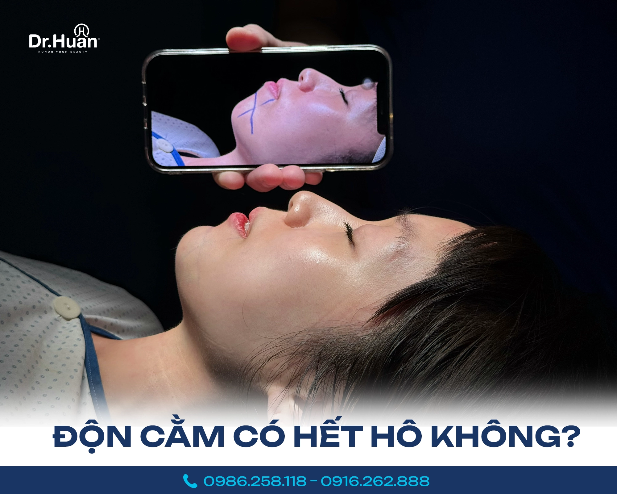 don-cam-co-het-ho-khong-truong-hop-nao-co-the-cai-thien-1 don-cam-co-het-ho-khong-truong-hop-nao-co-the-cai-thien-1