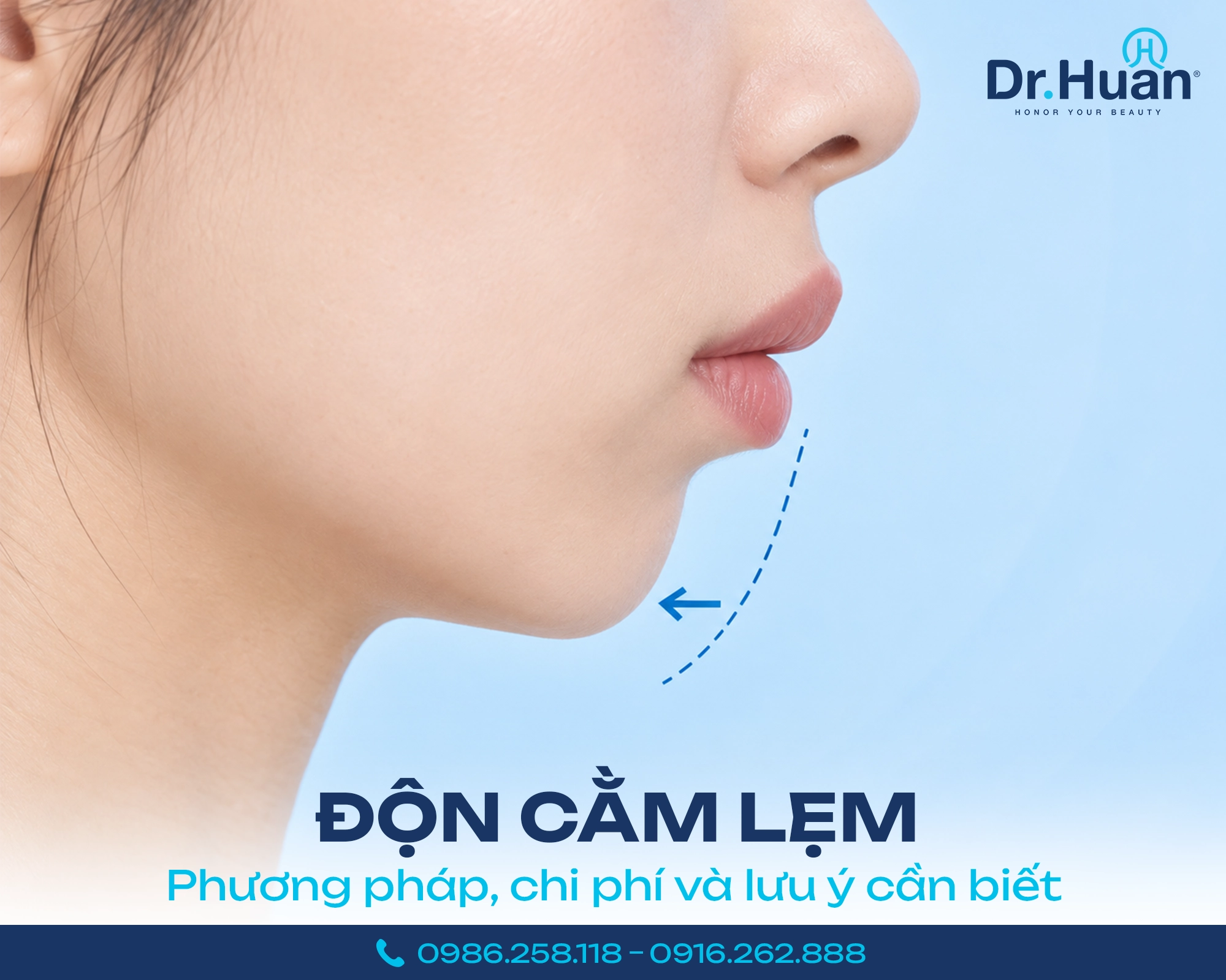 don-cam-lem-giai-phap-cai-thien-dang-cam-hai-hoa-1