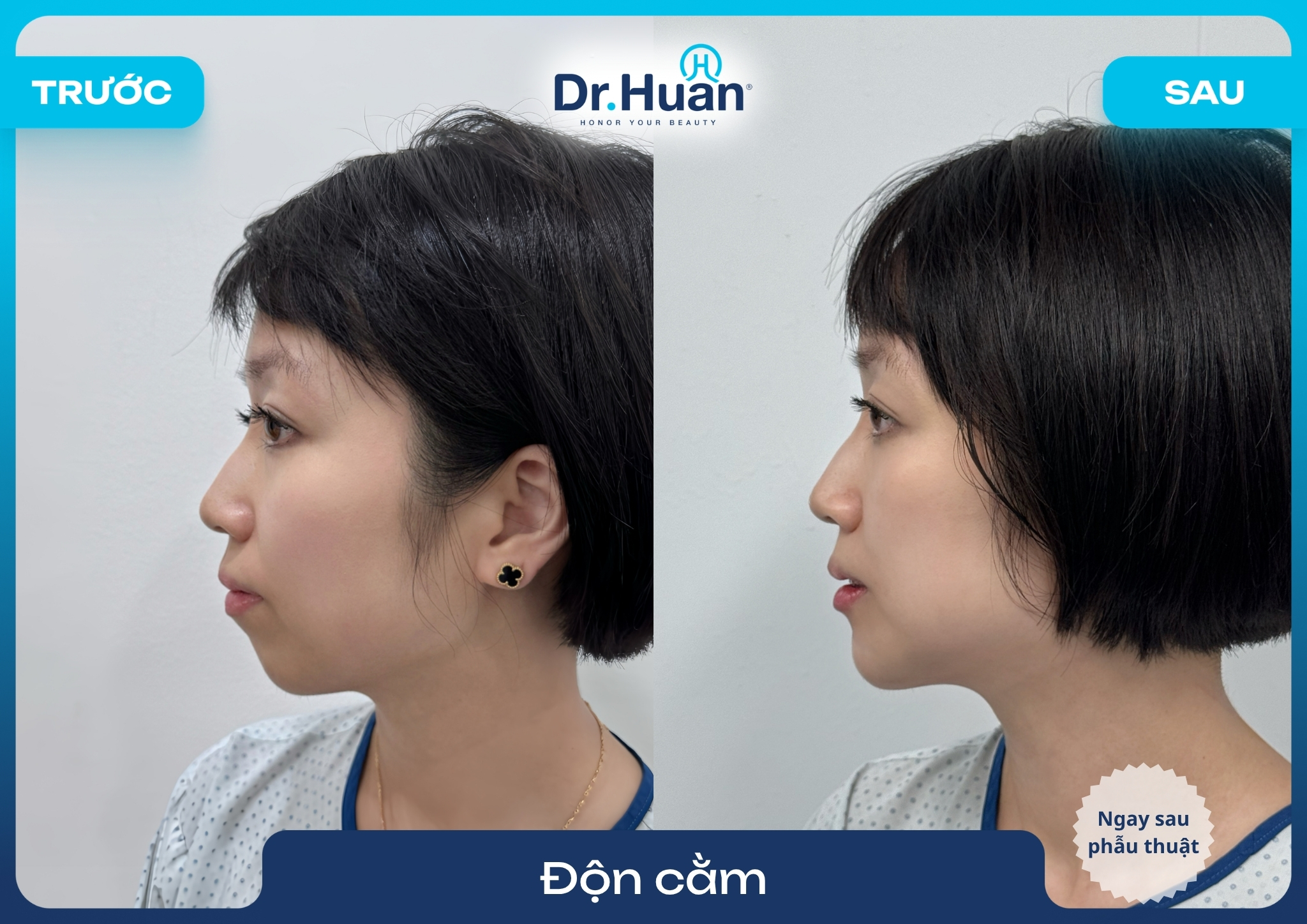 don-cam-lem-giai-phap-cai-thien-dang-cam-hai-hoa-2