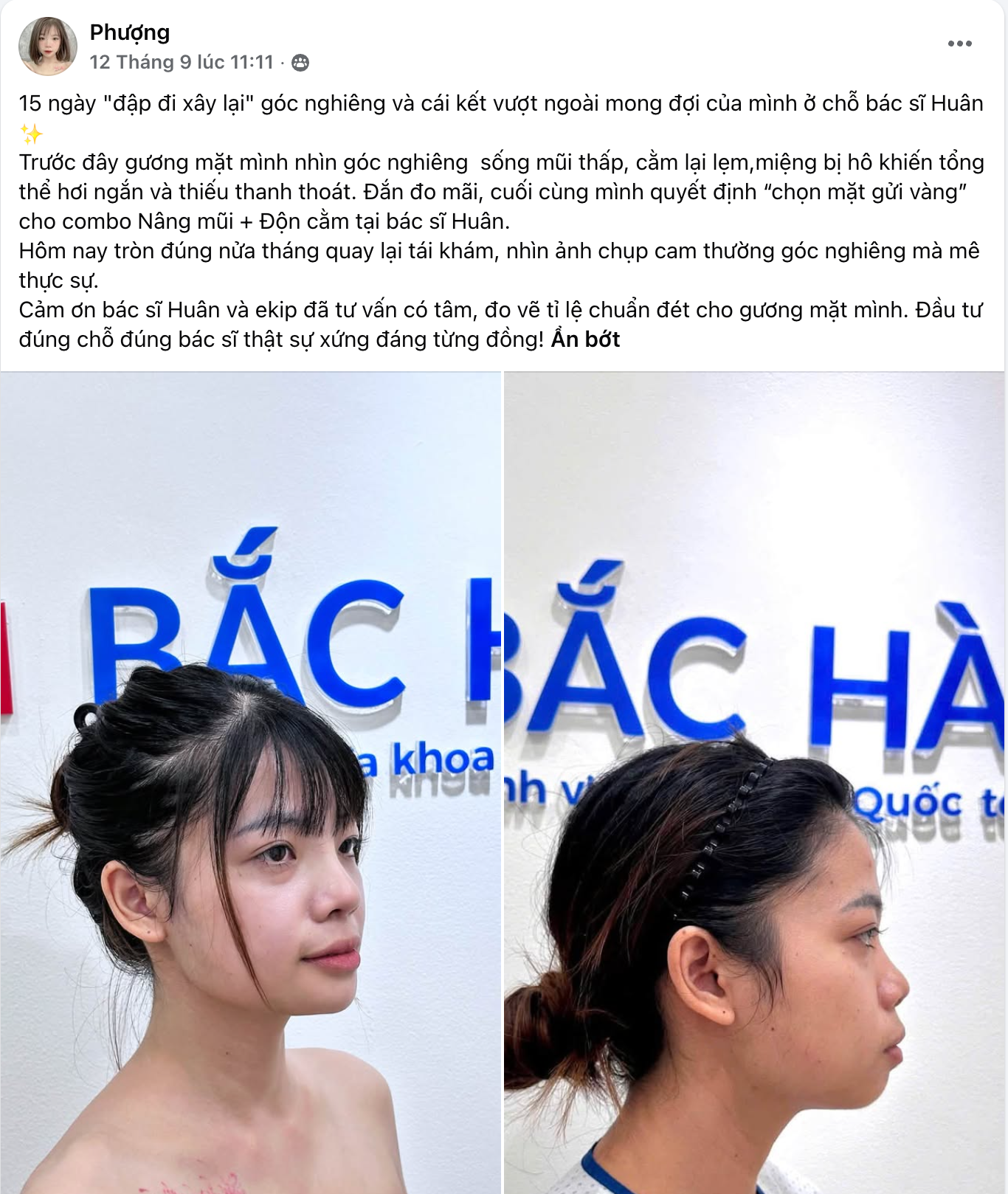 2 nang mui don cam