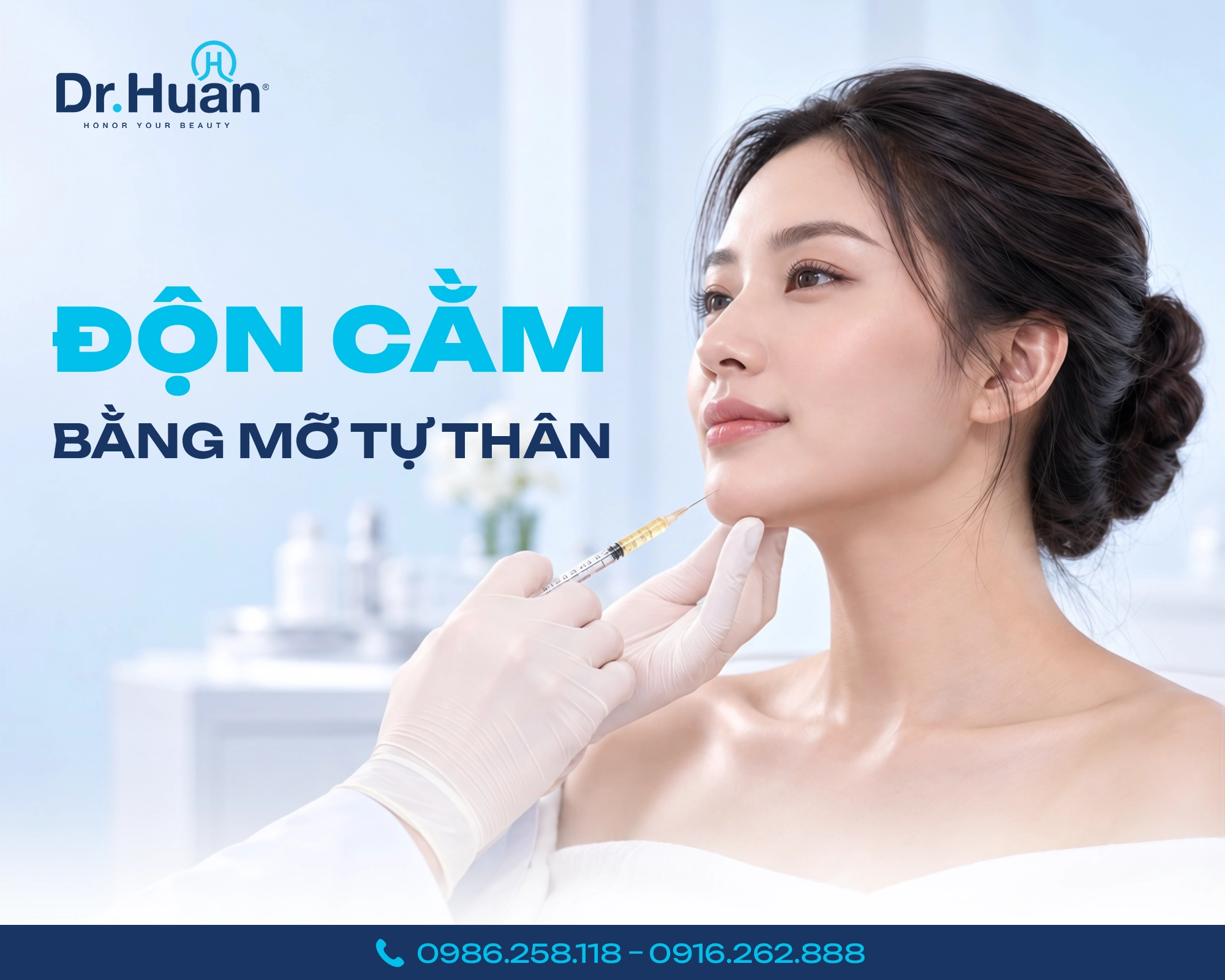 độn cằm bằng mỡ tự thân