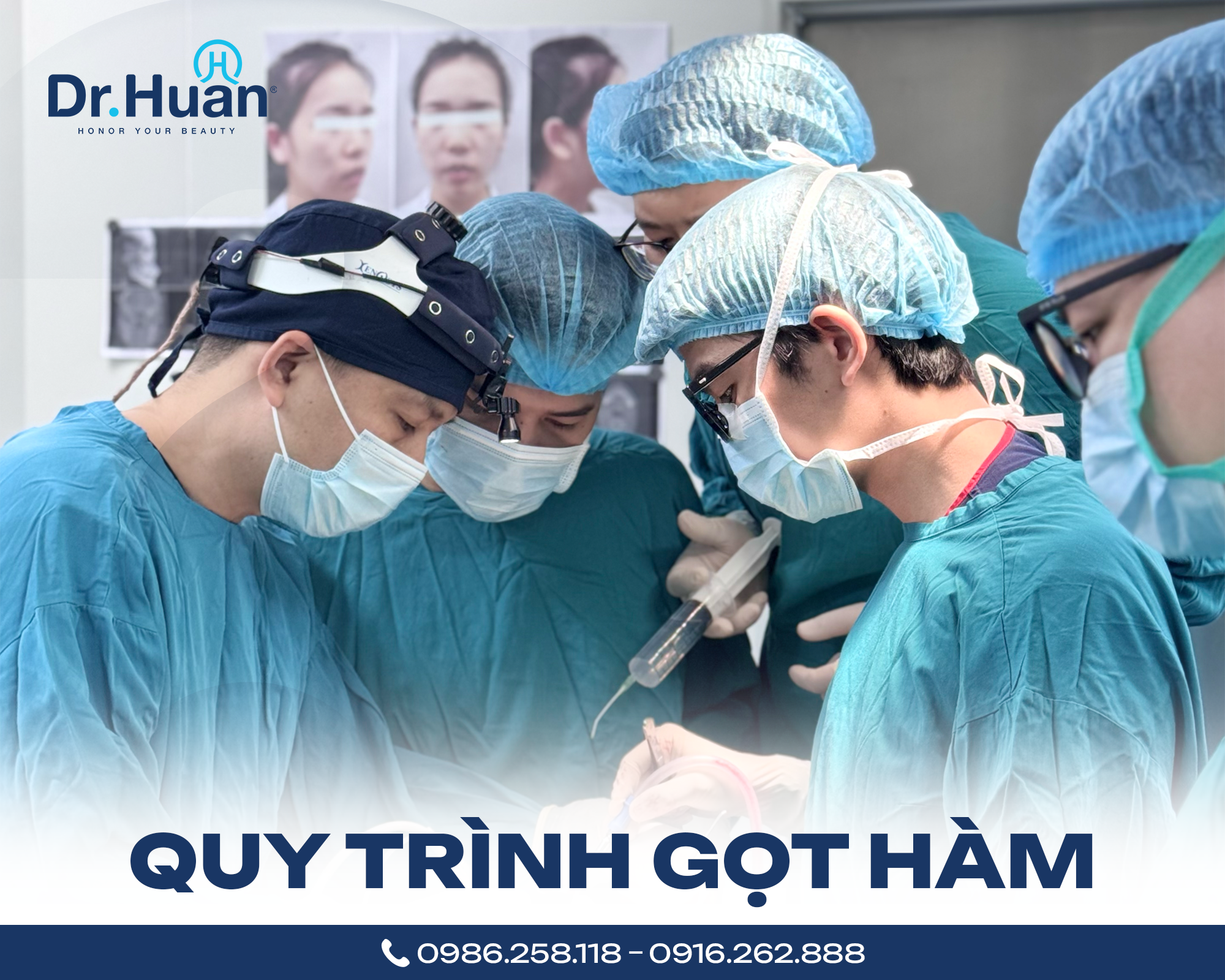 quy-trinh-got-ham