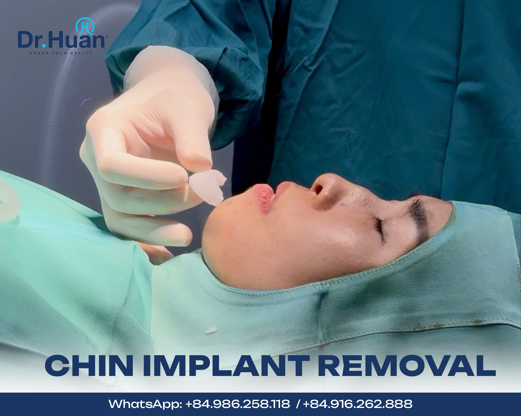 Chin implant removal