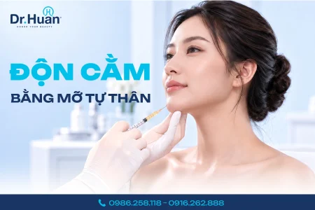 độn cằm bằng mỡ tự thân