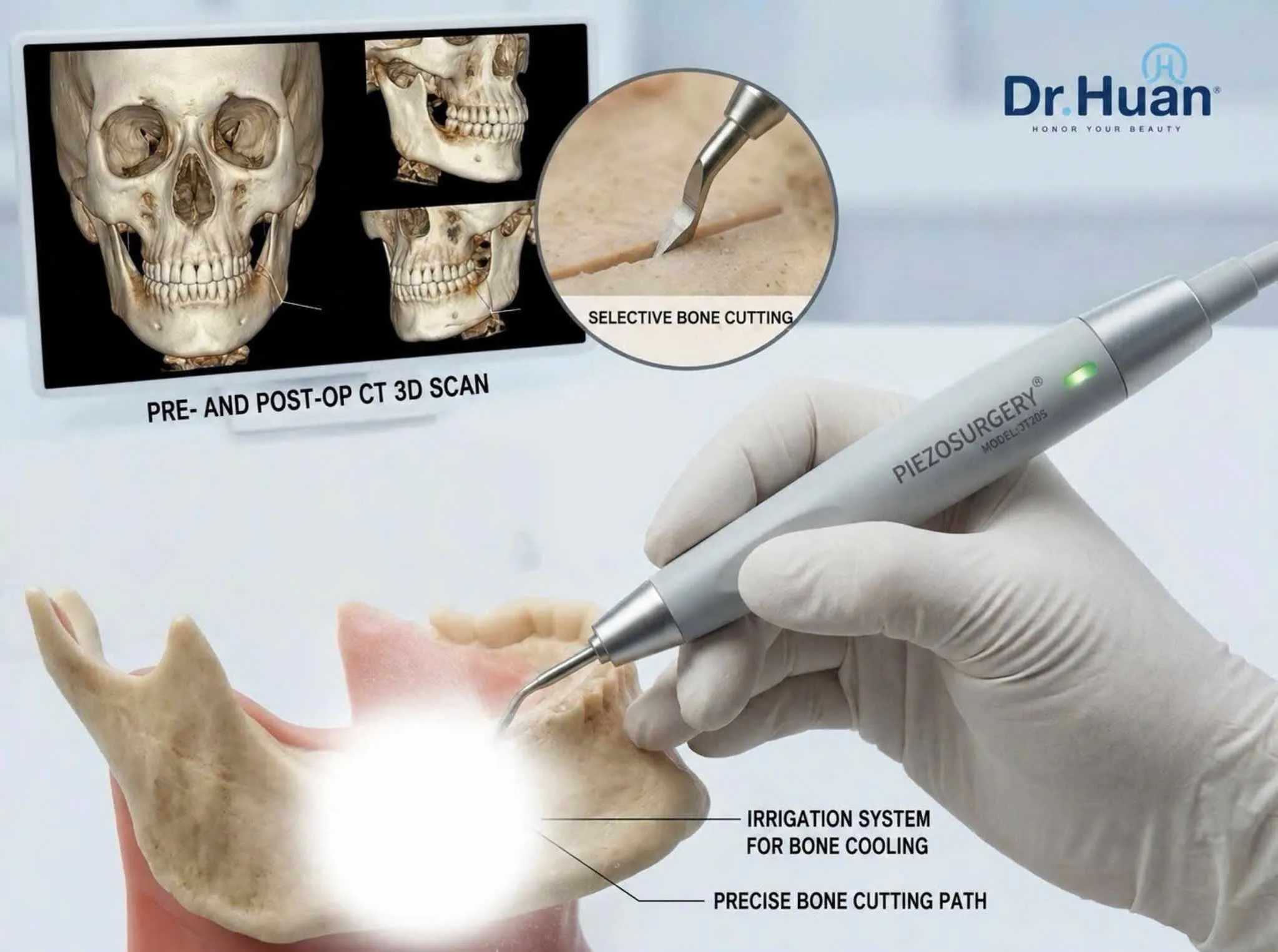 how-much-does-genioplasty-cost-latest-price-list-at-dr-huan-2