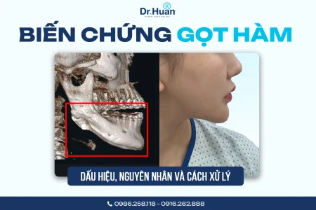 ien chung got ham