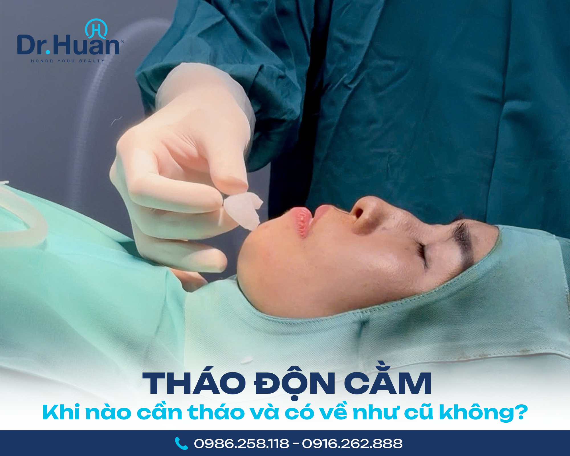 thao don cam