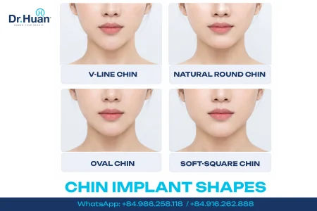 thumbnail Chin implant shapes