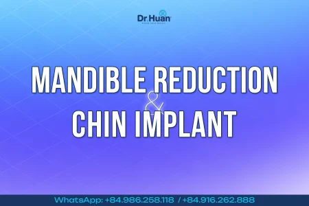 thumbnail mandible reduction chin implant