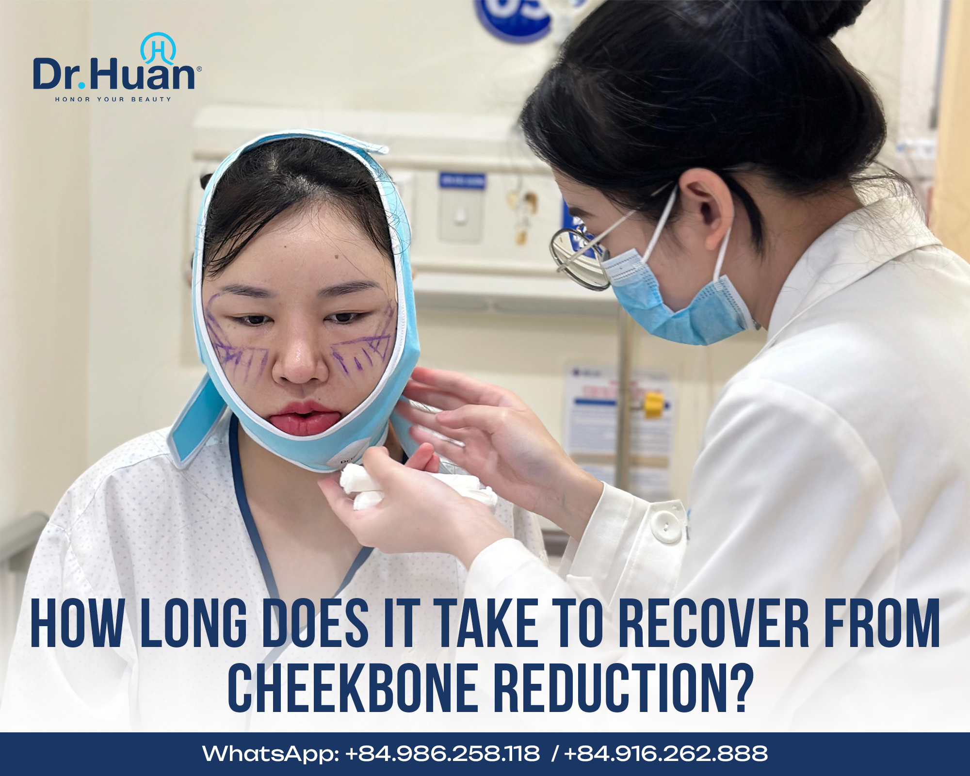 How-long-does-it-take-to-recover-from-cheekbone-reduction