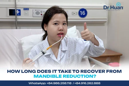How-long-does-it-take-to-recover-from-mandible-reduction