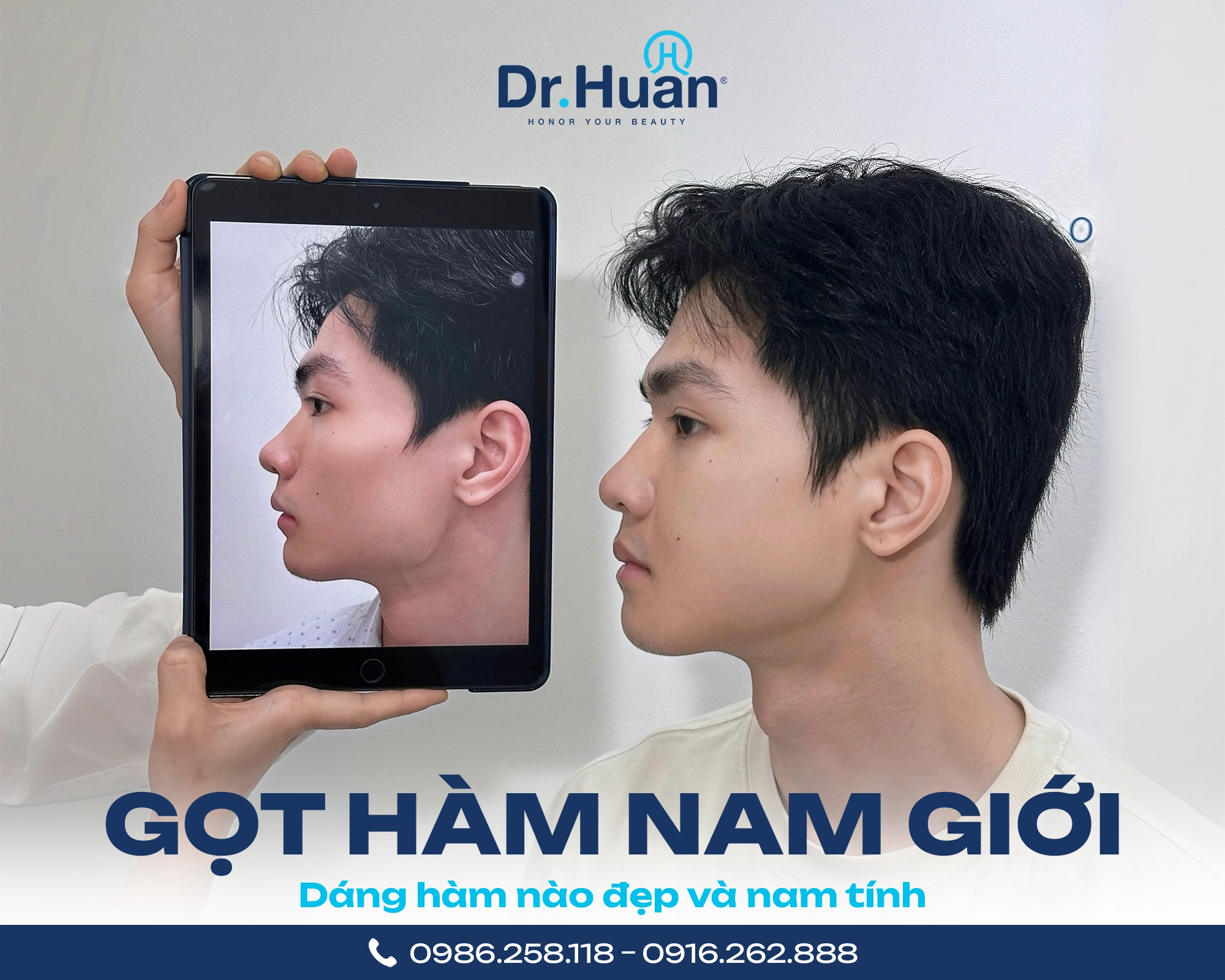 gọt hàm nam