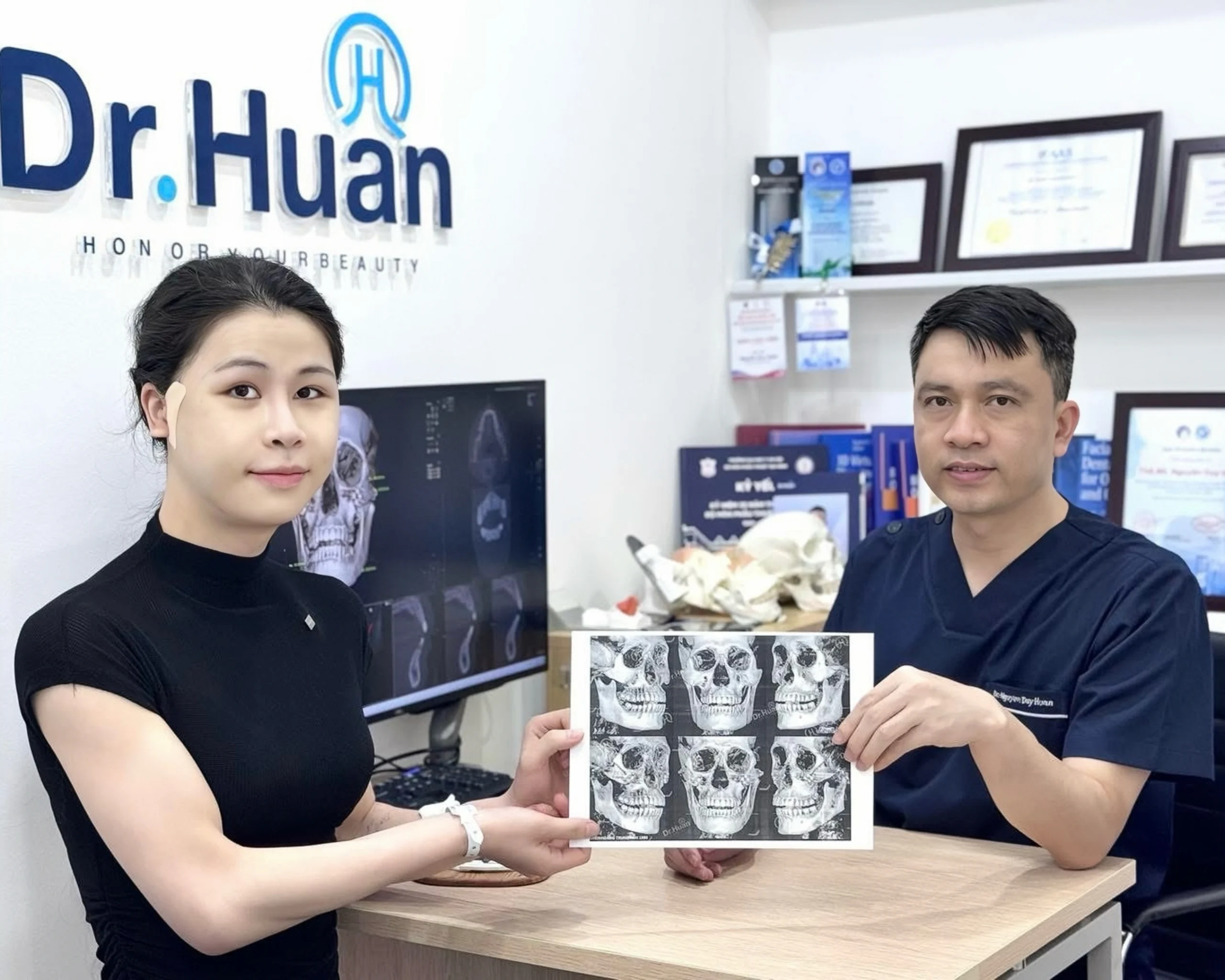 ha go ma bao nhieu tien 1