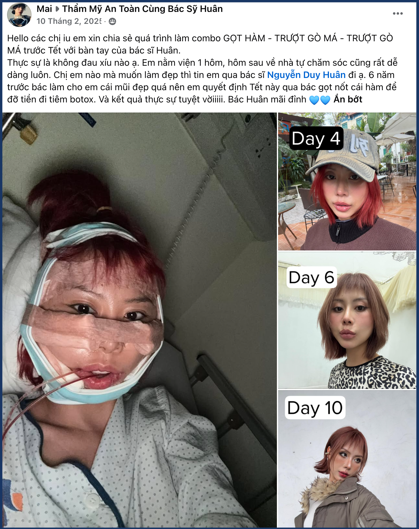 hagomabaolauhoiphuc