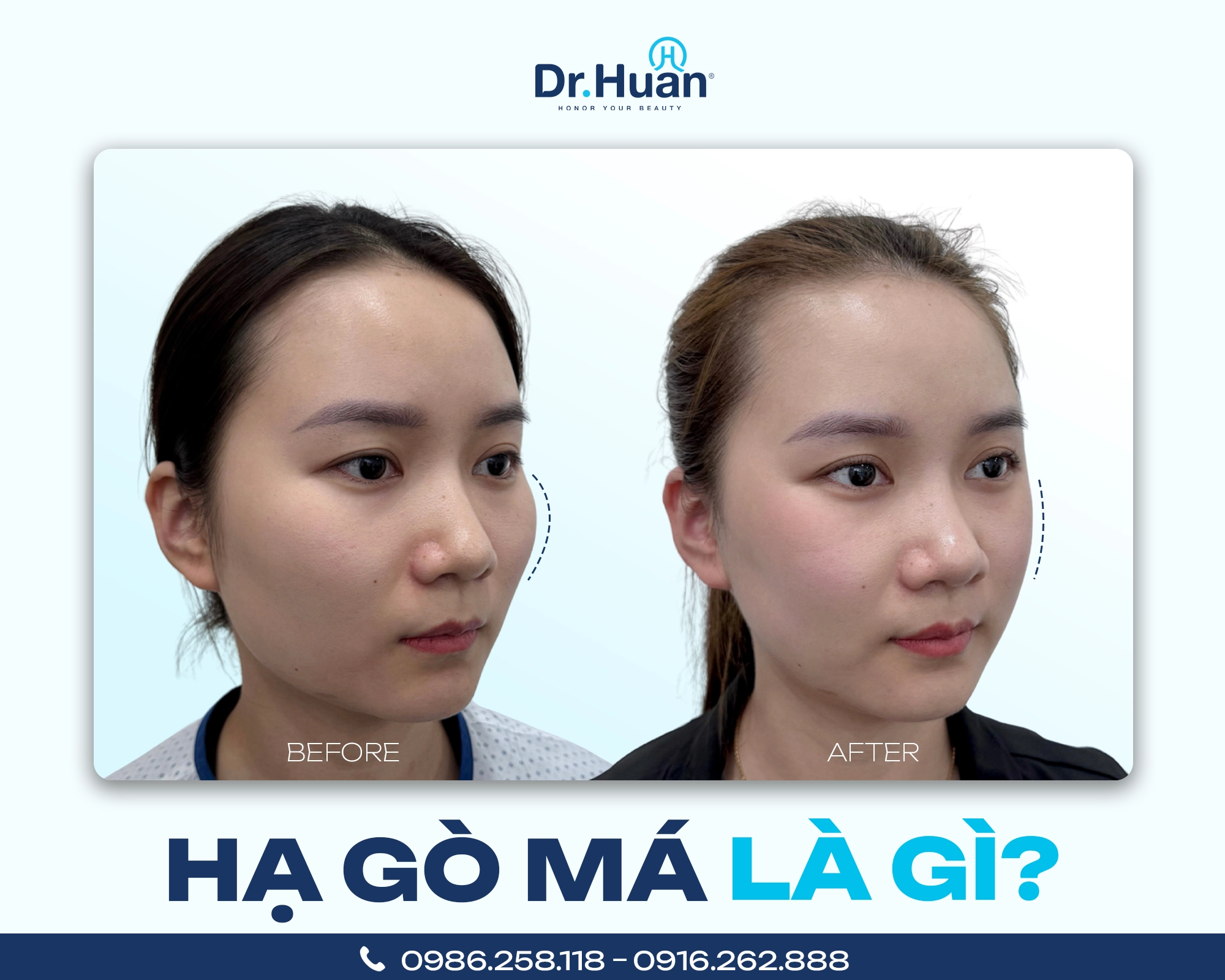 hagomalagi