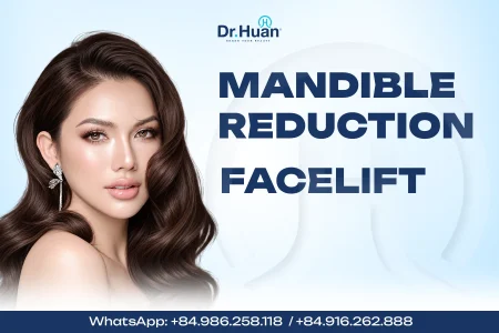 Mandible-reduction-and-facelift