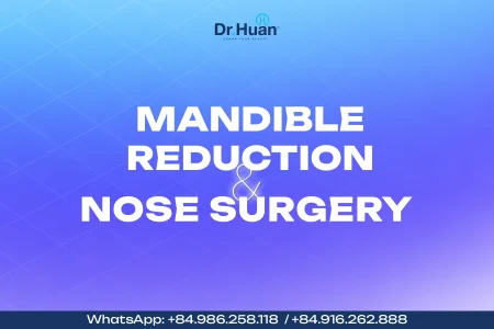 Mandible-reduction-and-nose-surgery