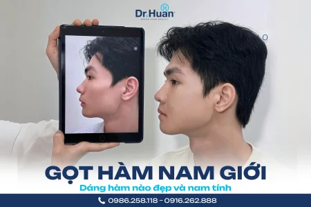 gọt hàm nam