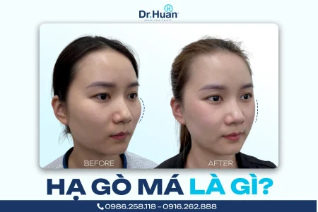 ha go ma la gi